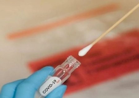 Idosa de 65 anos é a primeira vítima da Covid-19 do ano em MS