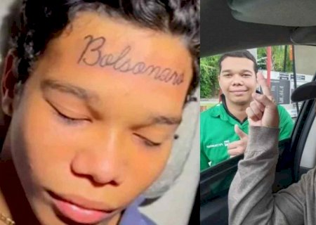 Jovem que tatuou “Bolsonaro” na testa remove tatuagem e posa ao lado de Bruno Gagliasso