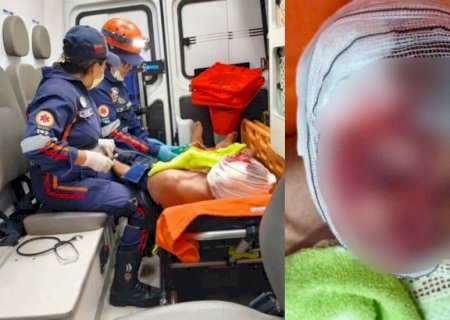 Idoso é atacado por cachorro e sofre múltiplas lacerações no rosto em Aquidauana