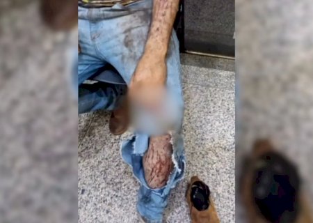 Trabalhador relata ter sido atacado por onça durante colheita>